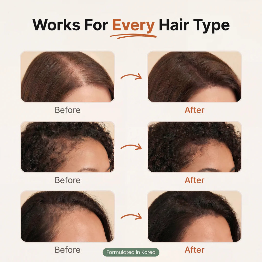 Korean Hair Growth Serum for Thinning Hair & Shedding