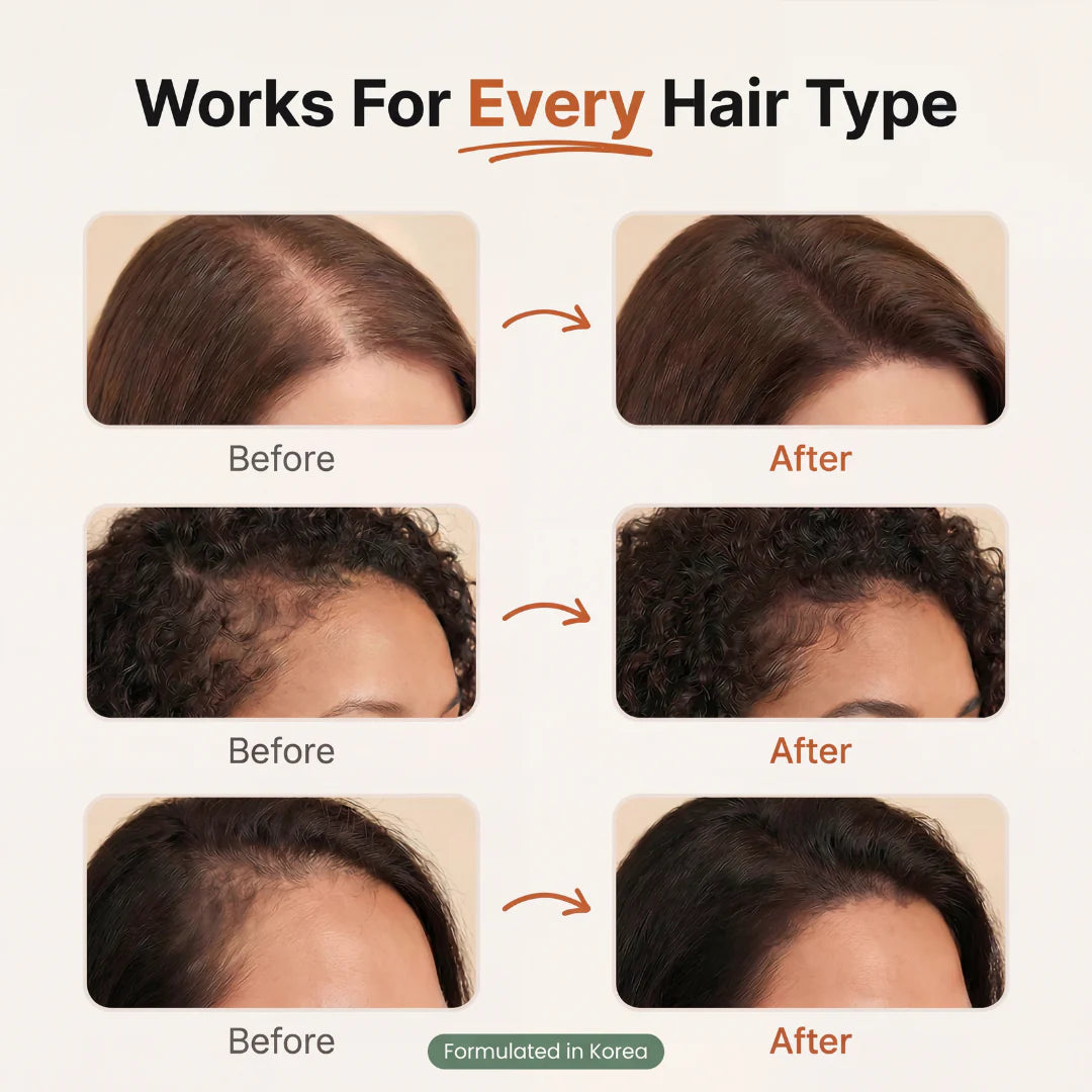 Korean Hair Growth Serum for Thinning Hair & Shedding