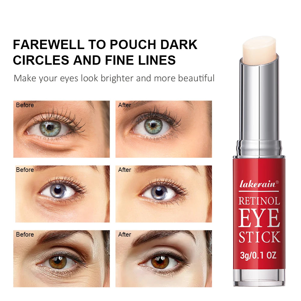 Retinol Eye Cream Stick For Dark Circles & Wrinkles